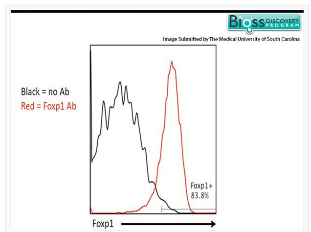 1 - FoxP1 Rabbit pAb AP94414