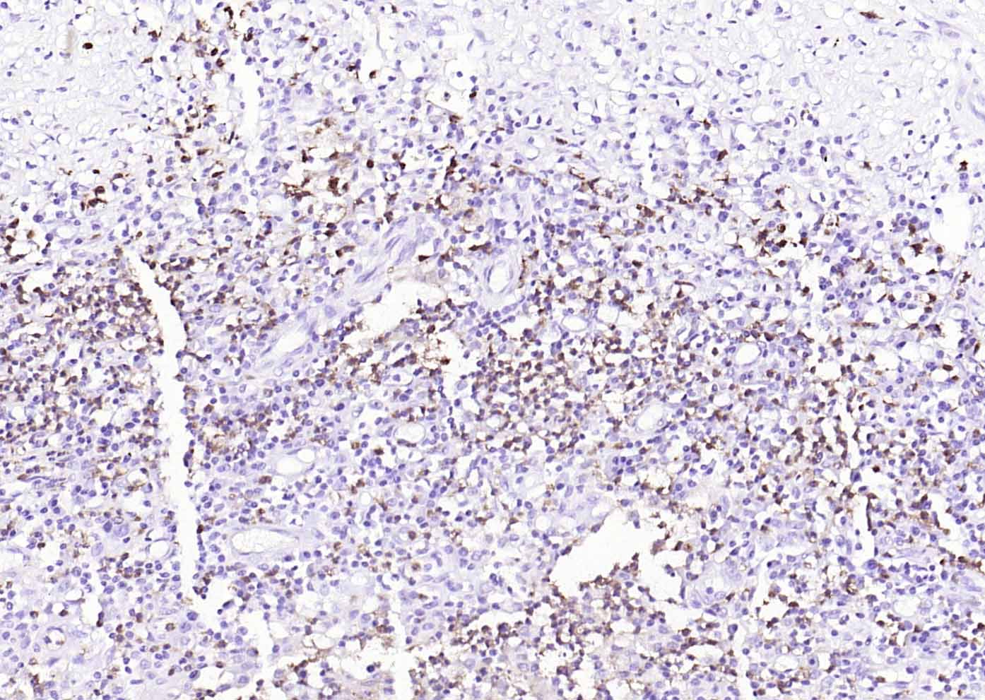 14 - human CD15 (SSEA-1) Mouse mAb AP94441