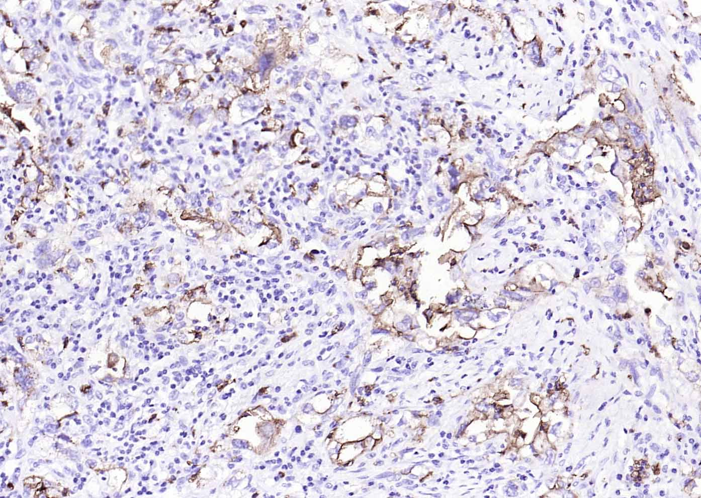 14 - human CD15 (SSEA-1) Mouse mAb AP94441