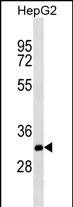 1 - THAP11 Mouse mAb AP94475