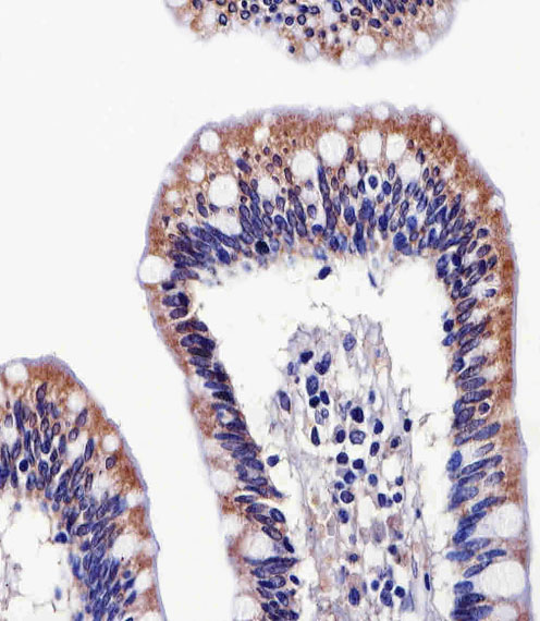 14 - ALDH6A1 Mouse mAb AP94563