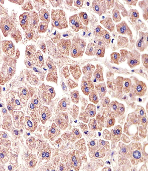 14 - ALDH6A1 Mouse mAb AP94563