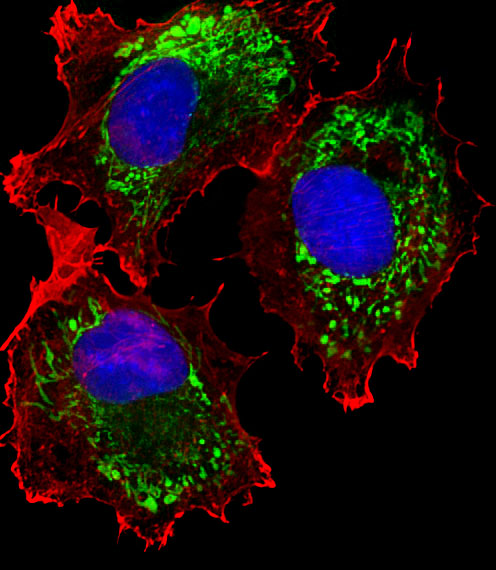 1 - ALDH6A1 Mouse mAb AP94563