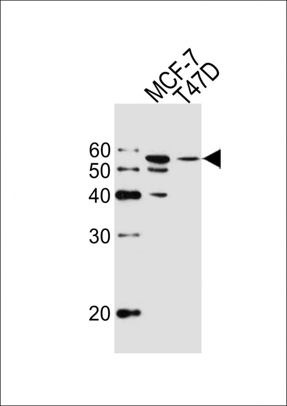 1 - ALDH6A1 Mouse mAb AP94563