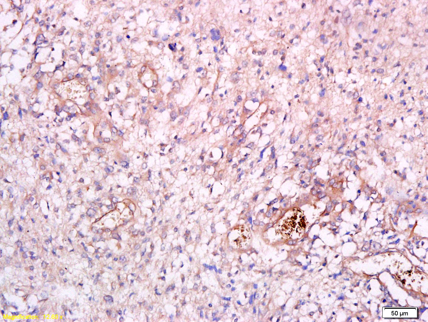 14 - CHI3L1 Rabbit pAb AP94706