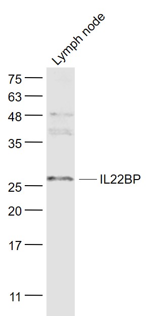 1 - IL22BP Rabbit pAb AP94729