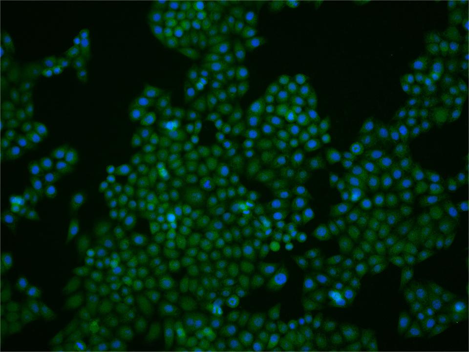 1 - FoxP1 Rabbit pAb AP94414
