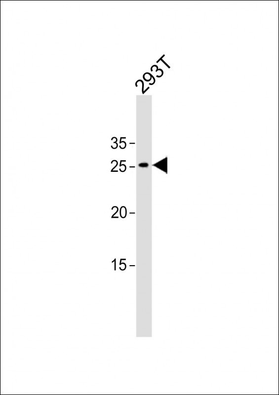 1 - SNRPB2 Antibody (N-term) AP12381a