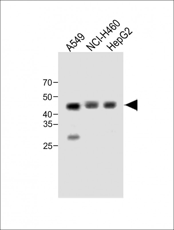 1 - ZNF883 Antibody (Center) AP19302c