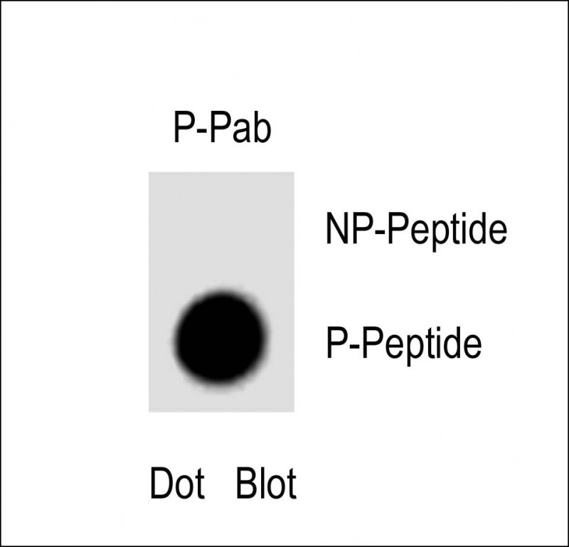 1 - Phospho-P21CIP1(T57) Antibody AP3190a