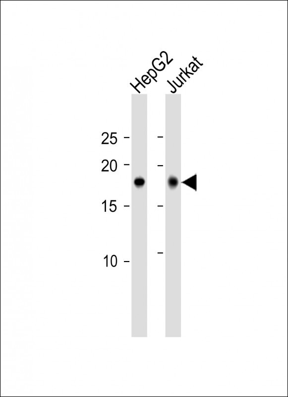 1 - CAMK2N1 Antibody (C-term) AP10235b