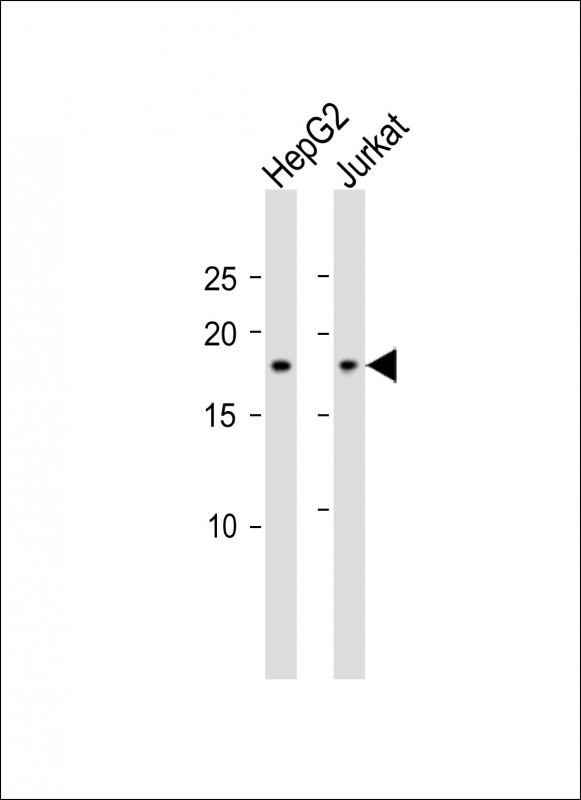 1 - CAMK2N1 Antibody (C-term) AP10235b