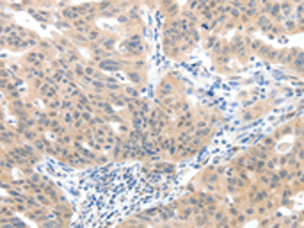 14 - SLC20A1 Rabbit pAb AP94846