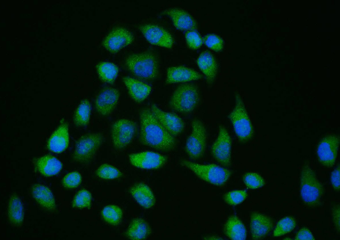 0 - phospho-IRAK1 (Ser376) Rabbit pAb AP50215