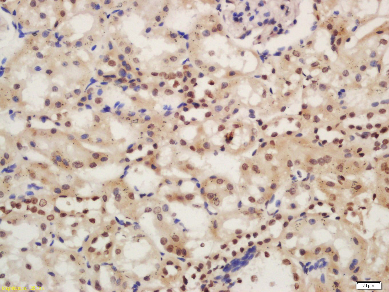 14 - phospho-IRAK1 (Ser376) Rabbit pAb AP50215