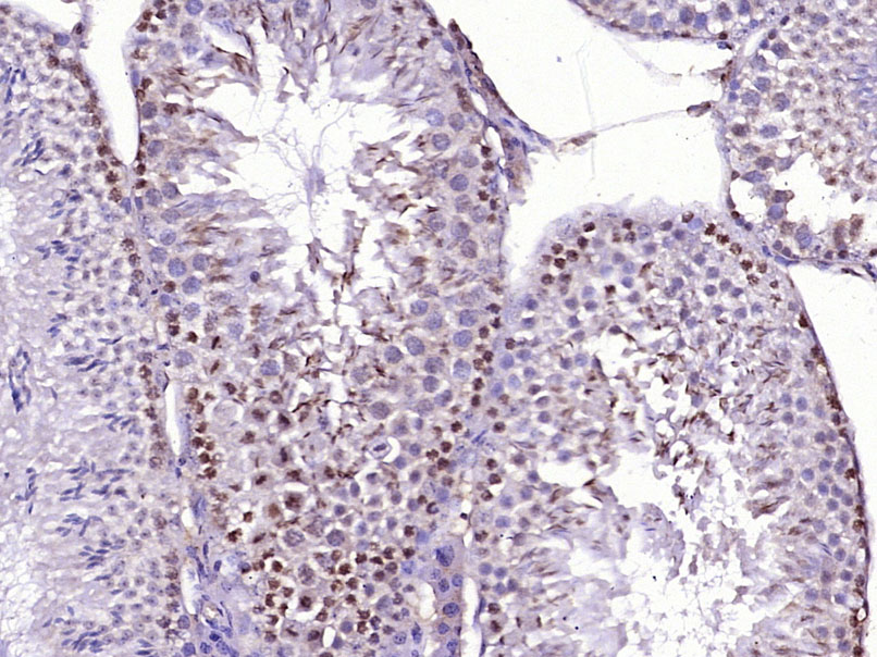 14 - JAZF1 Rabbit pAb AP50814