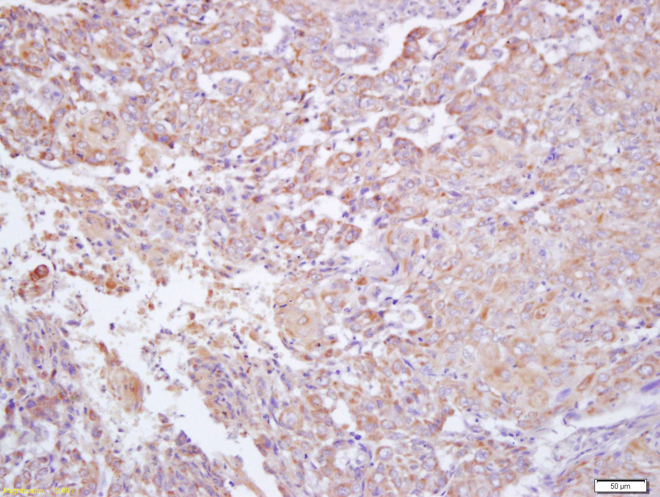 14 - IFNGR2 Rabbit pAb AP50884