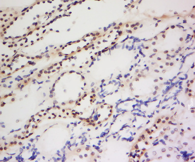 14 - PIWIL1 Rabbit pAb AP52028