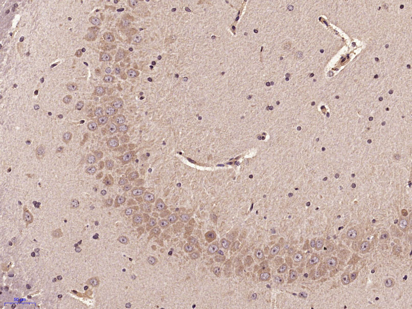 14 - SOCS2 Rabbit pAb AP52033