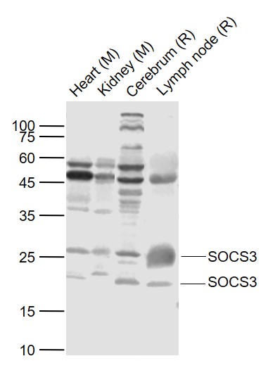 1 - SOCS3 Rabbit pAb AP52034