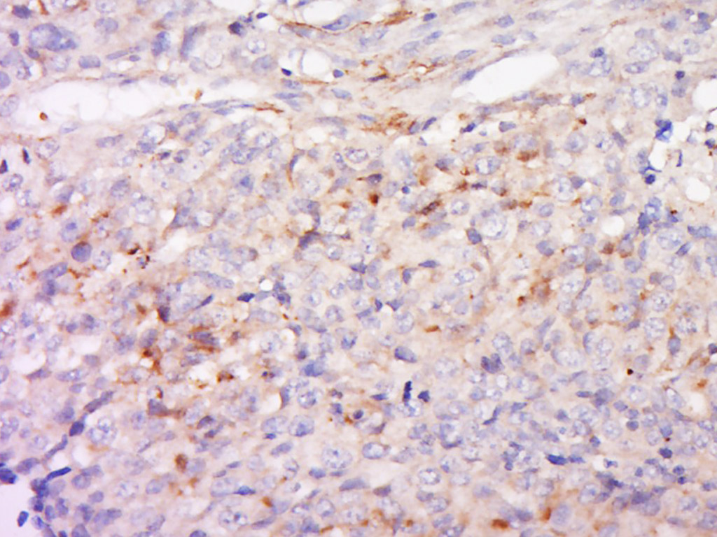 14 - Angiopoietin 2 Rabbit pAb AP52037