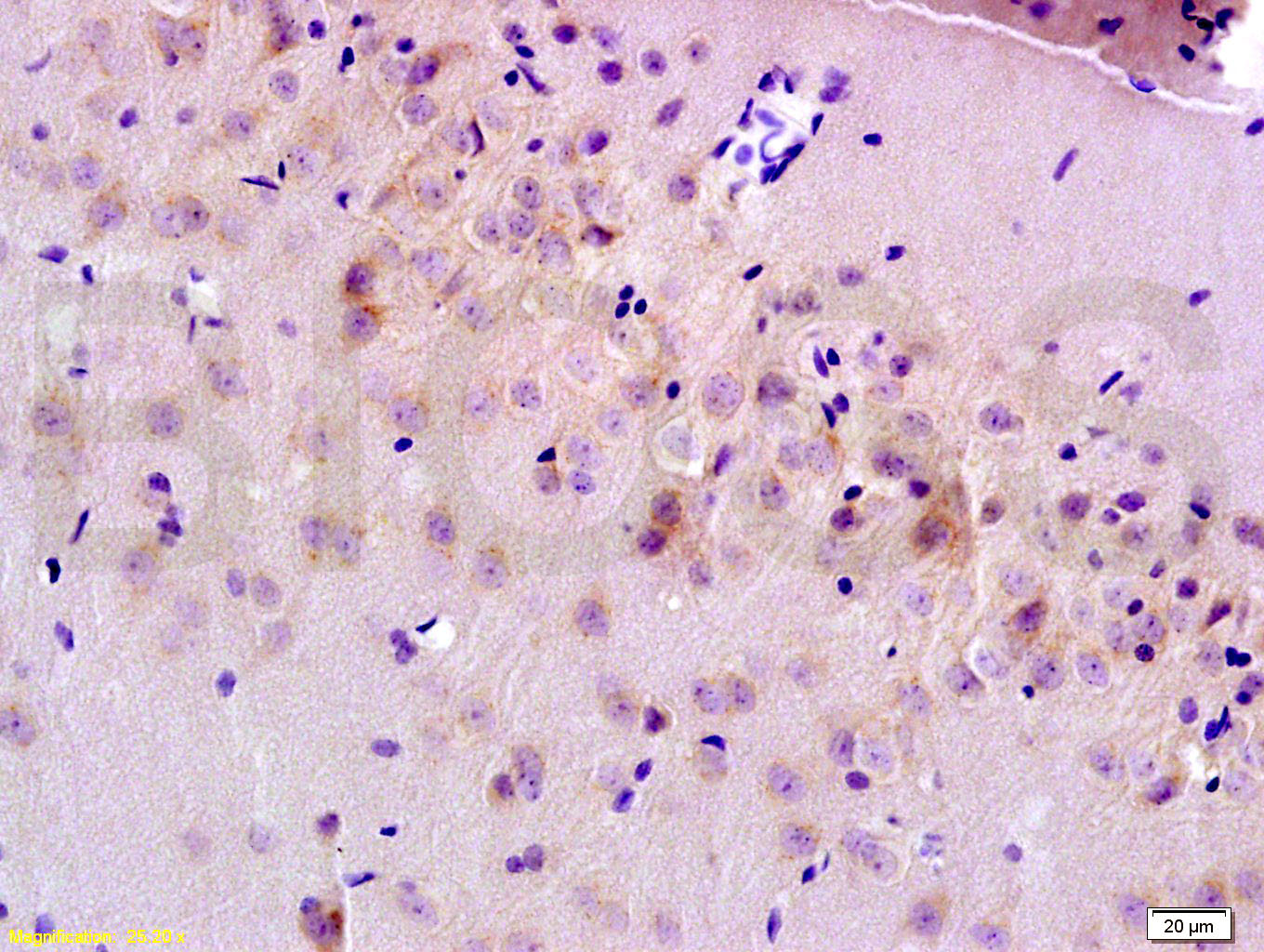 14 - MRP1/ABCC1 Rabbit pAb AP52039