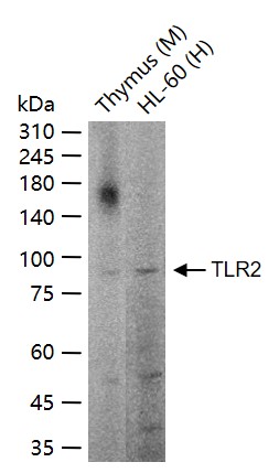 1 - TLR2 Rabbit pAb AP52046