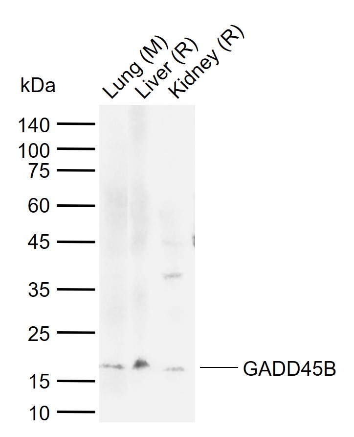 1 - GADD45B Rabbit pAb AP52049