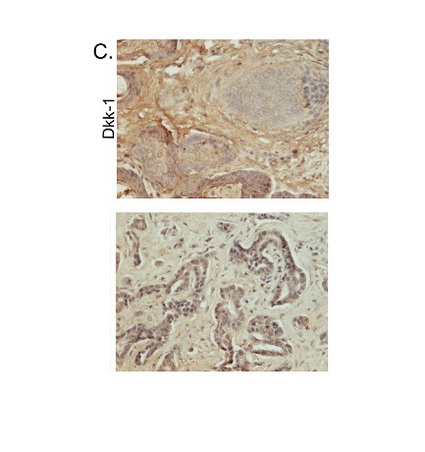 14 - DKK1 Rabbit pAb AP52055