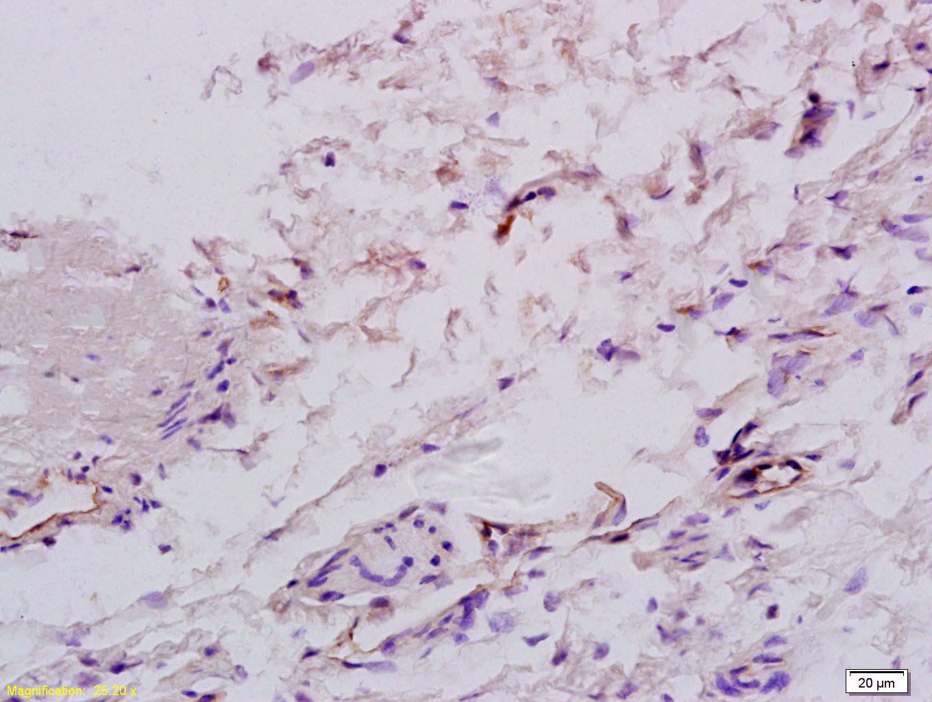 14 - factor VIII Rabbit pAb AP52057