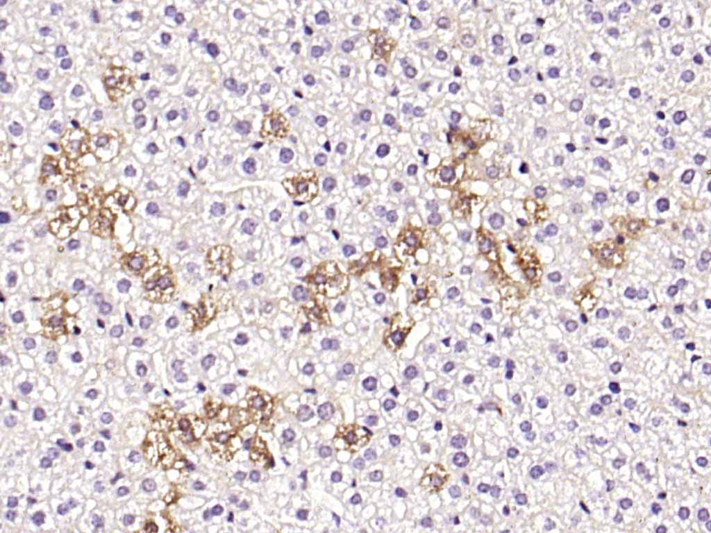 14 - Factor VIII Rabbit pAb AP52058