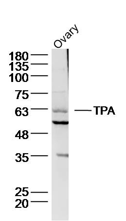 1 - TPA Rabbit pAb AP52059