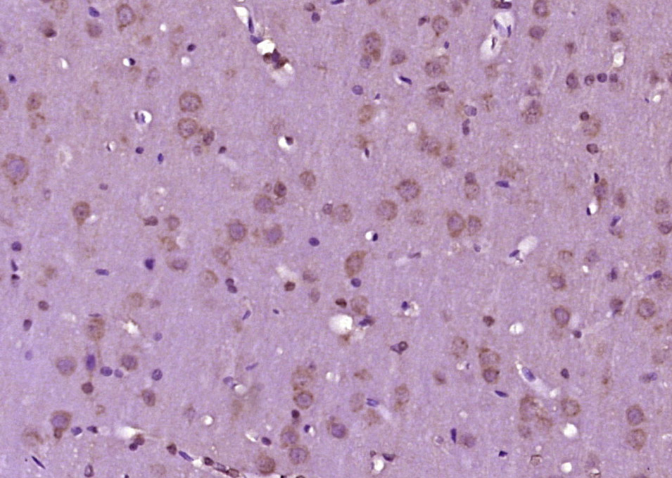 14 - CGRP-1/2 Rabbit pAb AP52064