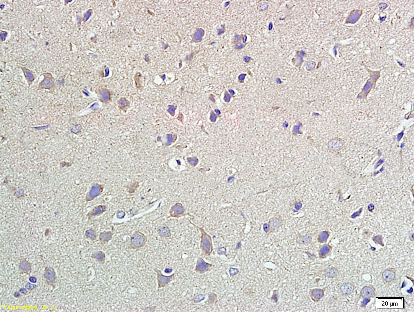 14 - Neuropeptide Y Rabbit pAb AP52065