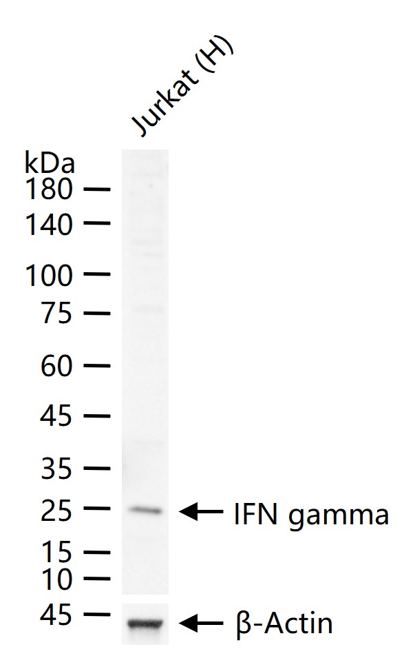 1 - IFN gamma Rabbit pAb AP52068