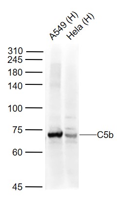 1 - C5b-9 Rabbit pAb AP52073
