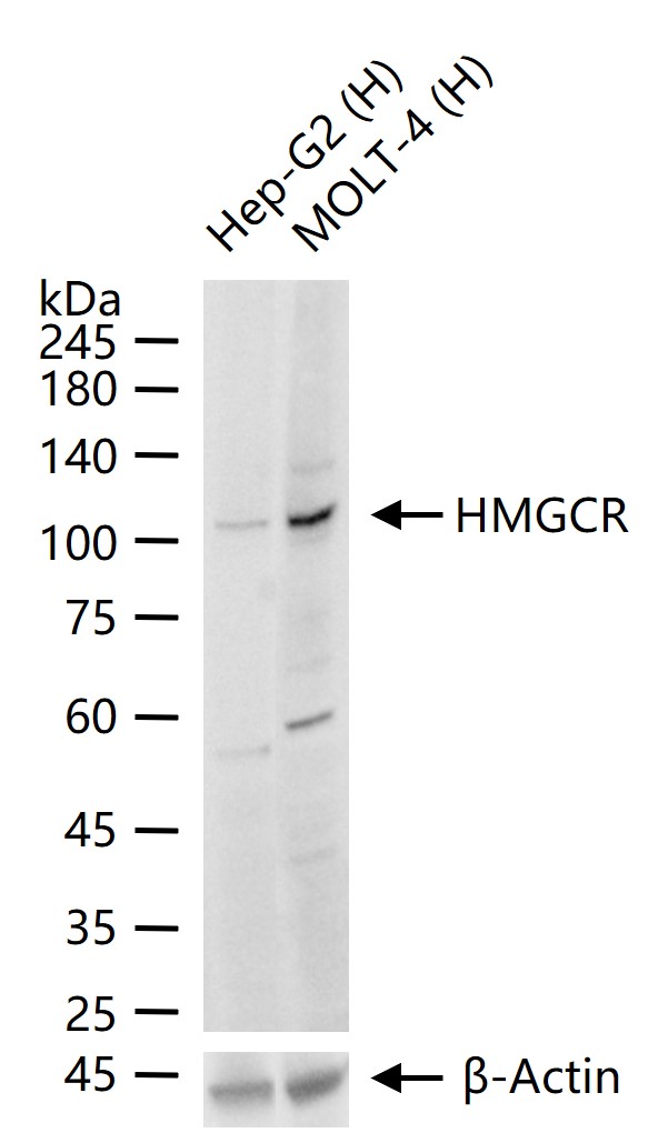1 - HMGCR Rabbit pAb AP52077