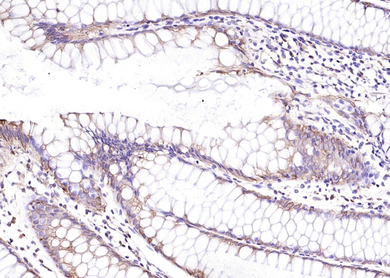 14 - Cytokeratin 8 Rabbit pAb AP52086
