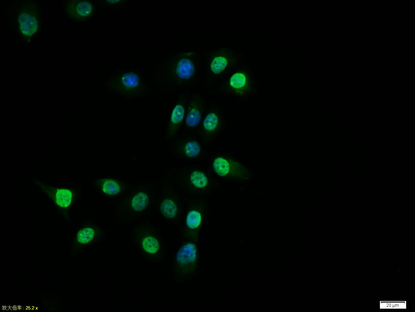 0 - Estrogen Receptor alpha Rabbit pAb AP52088