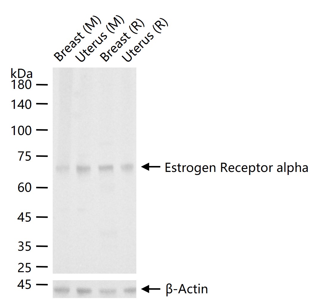 1 - Estrogen Receptor alpha Rabbit pAb AP52088