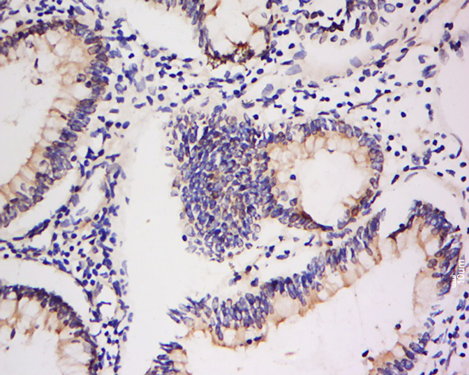 14 - Integrin  Alpha V + Beta 5 Rabbit pAb AP52091