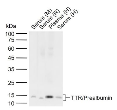1 - TTR/TTR/Prealbumin Rabbit pAb AP52094