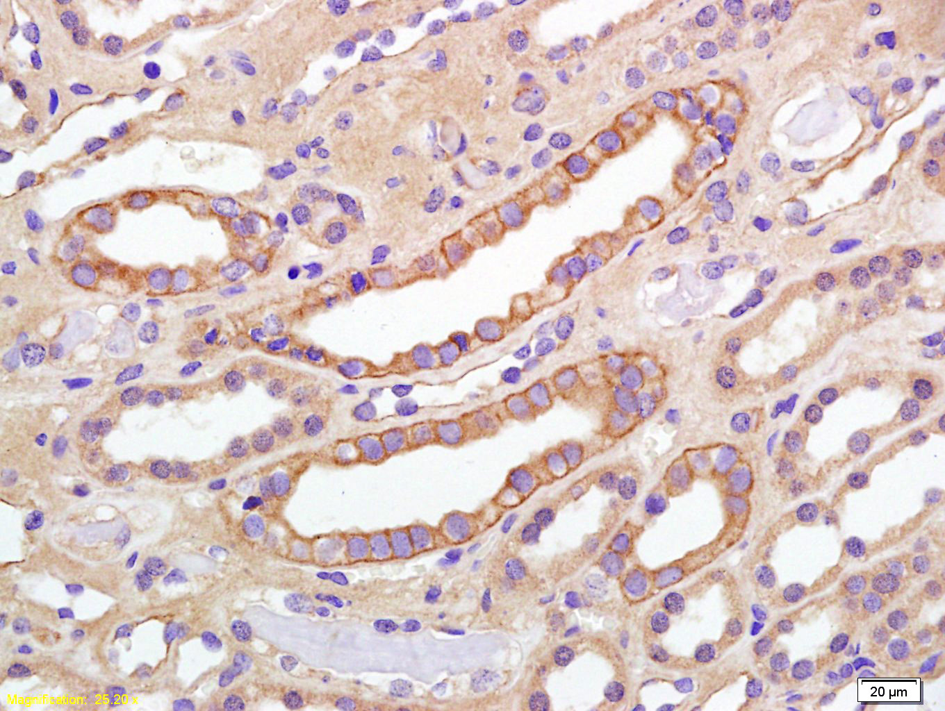 14 - phospho-IGF1R (Tyr980) Rabbit pAb AP52099