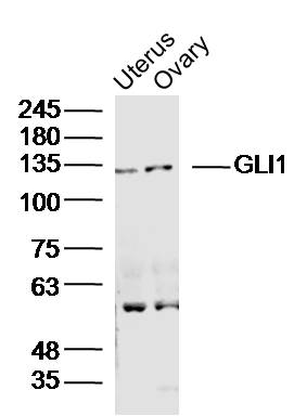 1 - GLI1 Rabbit pAb AP52100
