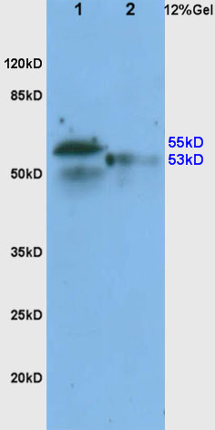 1 - ADRB1 Rabbit pAb AP52101
