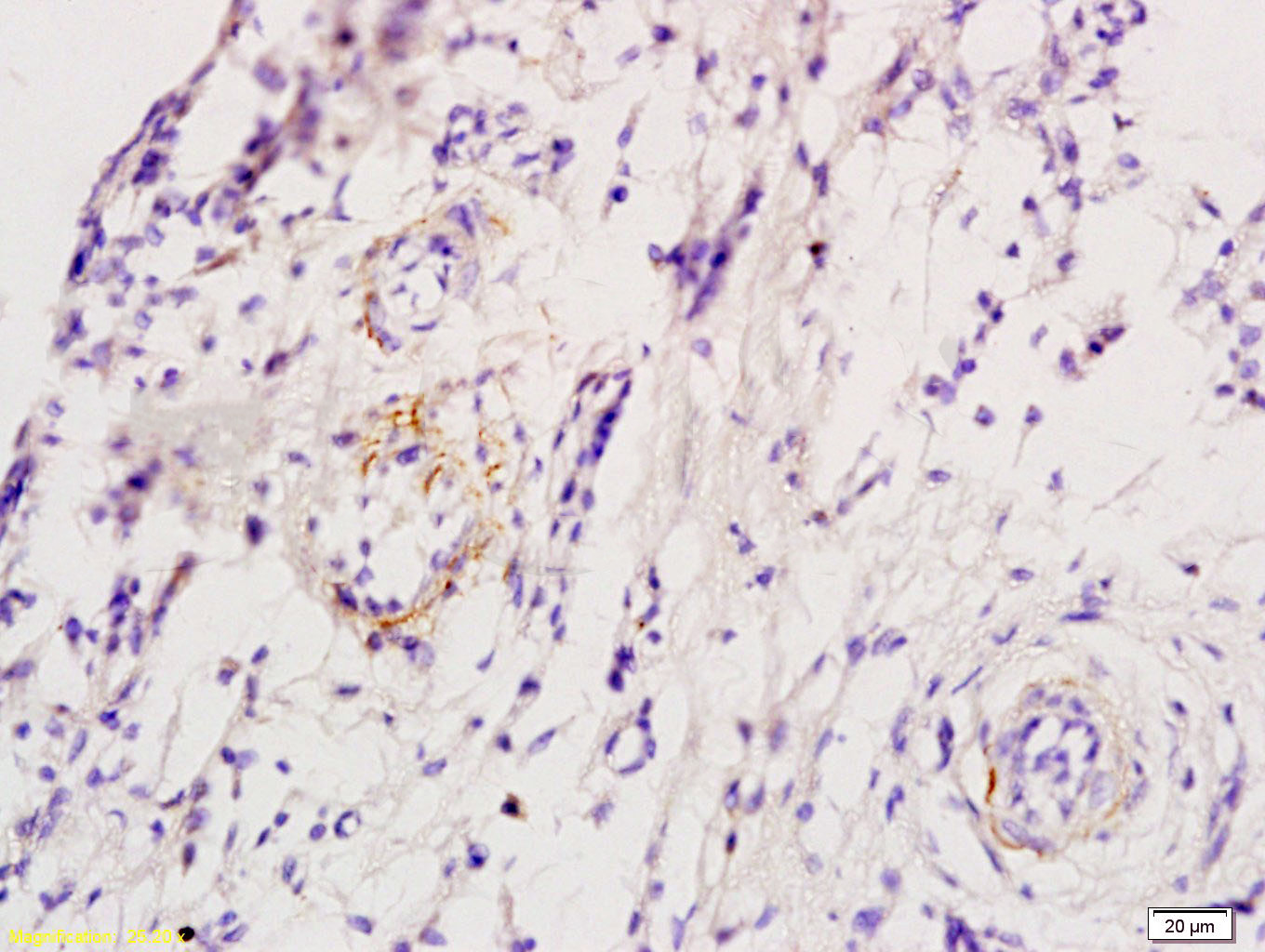 14 - ADRB1 Rabbit pAb AP52101