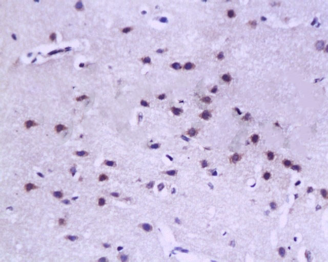 14 - RPSA Rabbit pAb AP52103