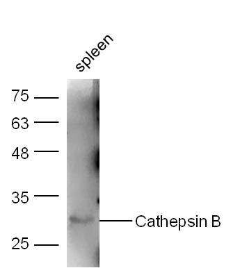 1 - Cathepsin B Rabbit pAb AP52109