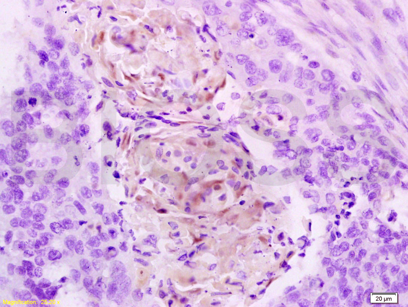14 - Cathepsin B Rabbit pAb AP52109