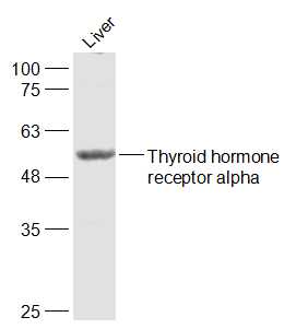 1 - Thyroid hormone receptor alpha Rabbit pAb AP52112